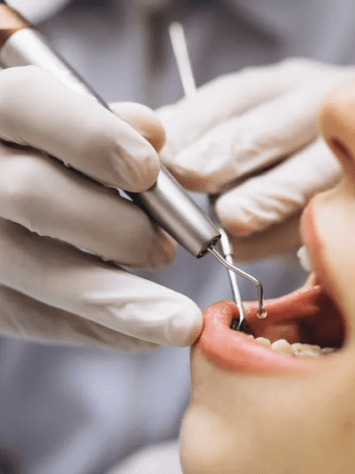 Dentistas